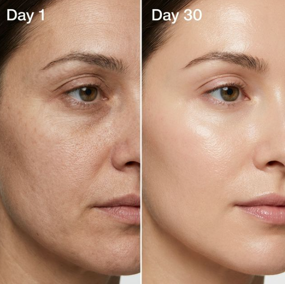 Skin Transformation